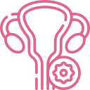 Ovary Cancer